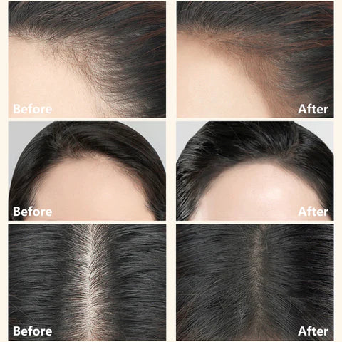 Imported™ 2 in 1 Perfect Hairline & Eyebrow Shaping Stamp [Buy 1 Get 1 Free Save Upto 50% Off] 🎁