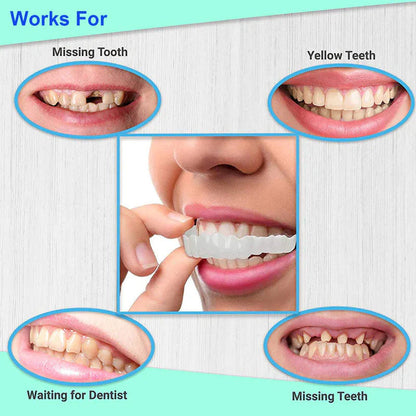 Instant Smile Reusable Snap On Veneers